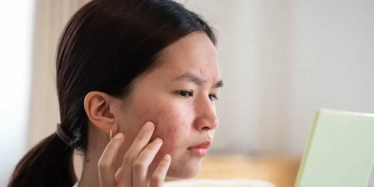 Skincare coreano: Errores comunes en tu rutina y cómo evitarlos