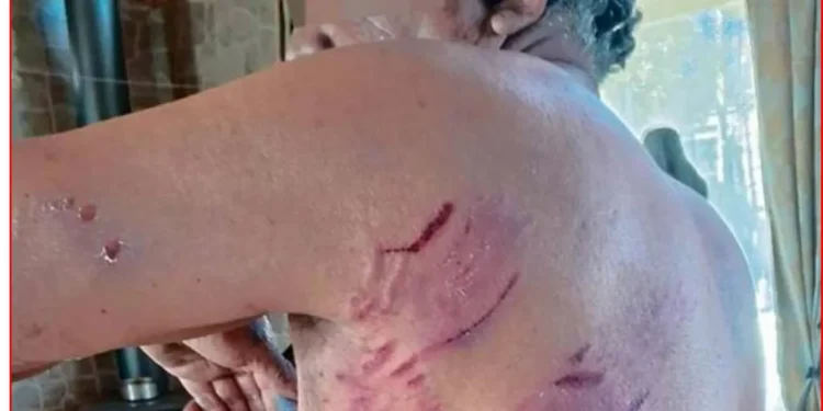 rape de El Tabo sufre feroz ataque de jauría en la playa