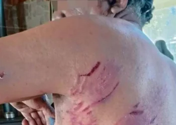 rape de El Tabo sufre feroz ataque de jauría en la playa