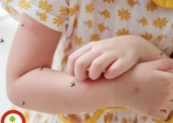 Dengue y chikungunya: ¿Cuáles son las diferencias y síntomas de sorpresa?