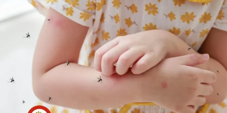 Dengue y chikungunya: ¿Cuáles son las diferencias y síntomas de sorpresa?