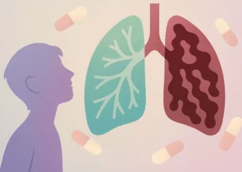 Pacientes con fibrosis quística viven solo 21 años en media en México