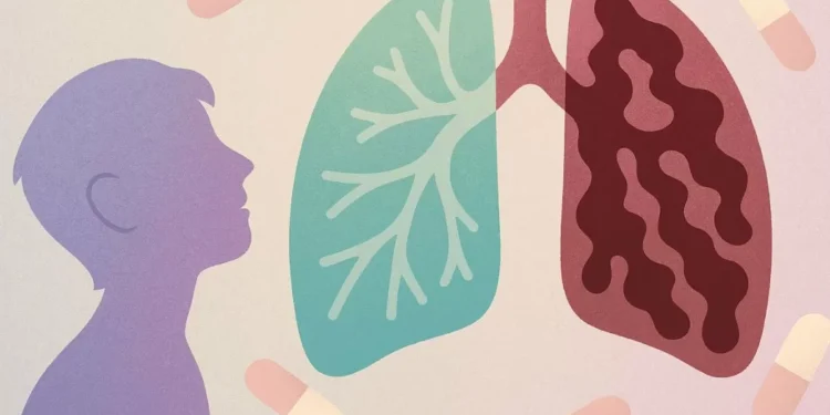 Pacientes con fibrosis quística viven solo 21 años en media en México