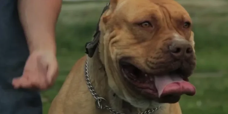 Niña fue mordida por un pitbull de su familia en Ciudad del pasta; en 2025 hubo unas 4 mil denuncias por casos similares